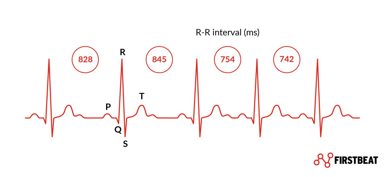 HRV Image